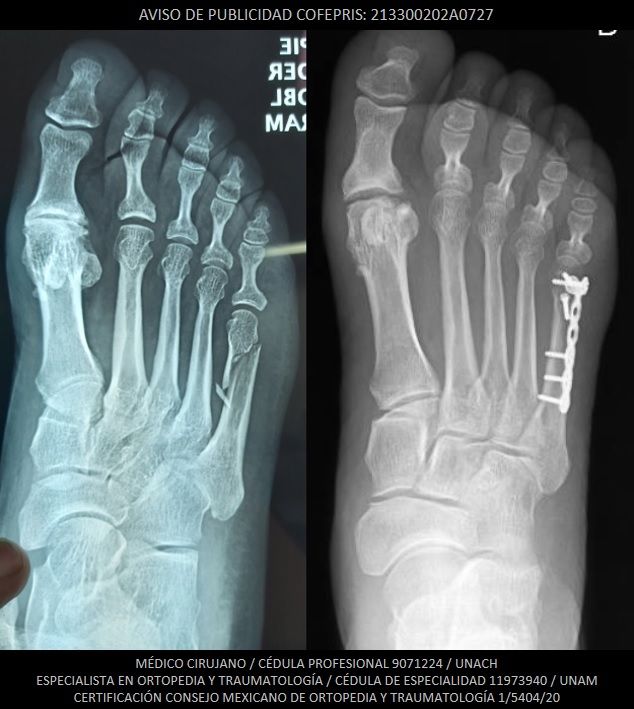 Luis Castañón Robles-6