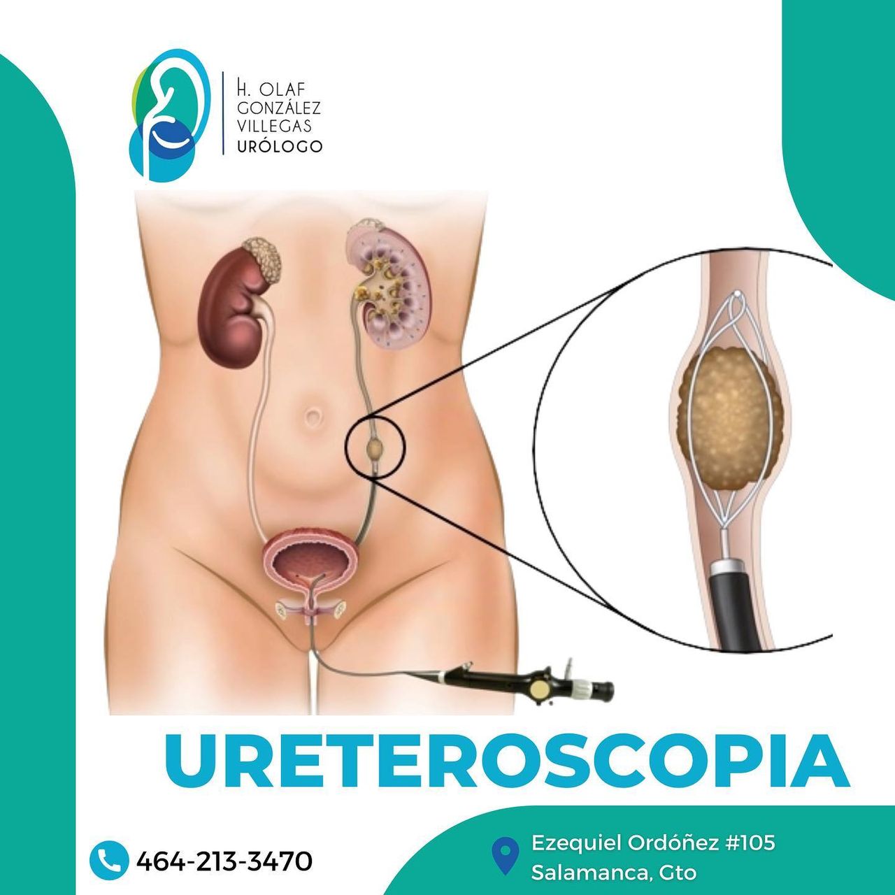 H.olaf Gonzalez Villegas-8