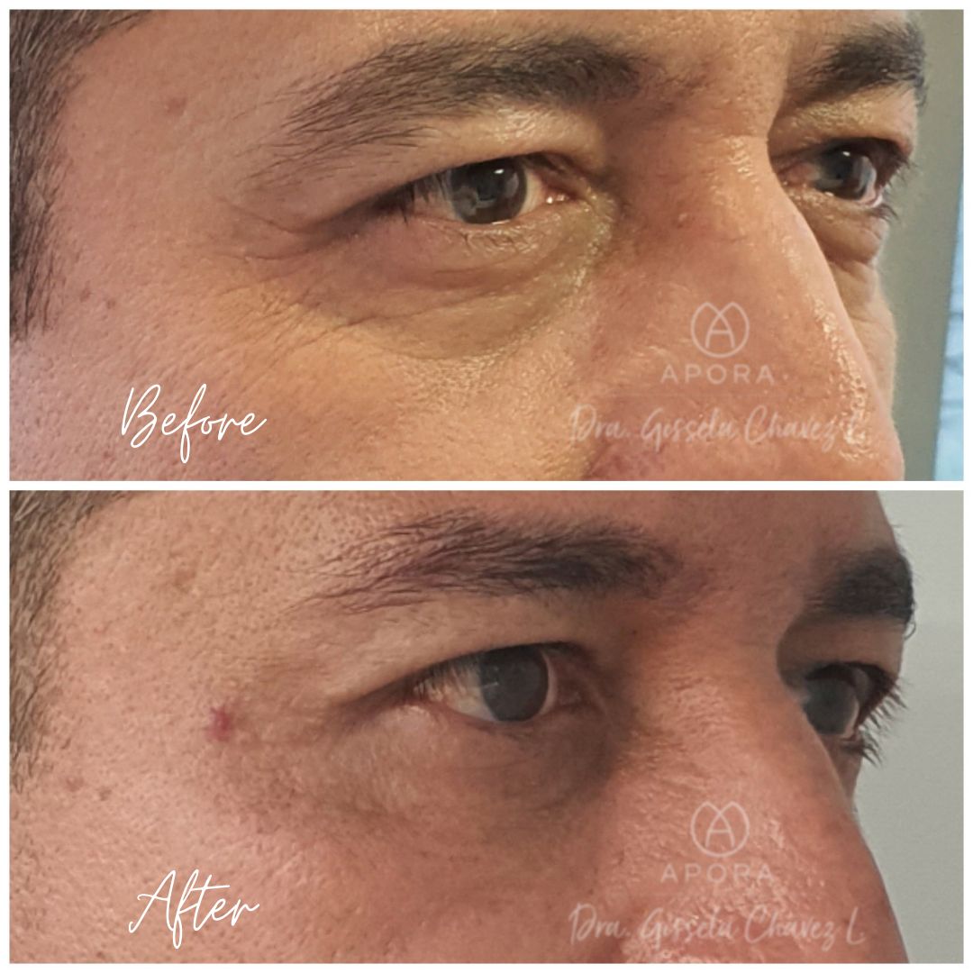 Gissela Chávez Lizardi-26