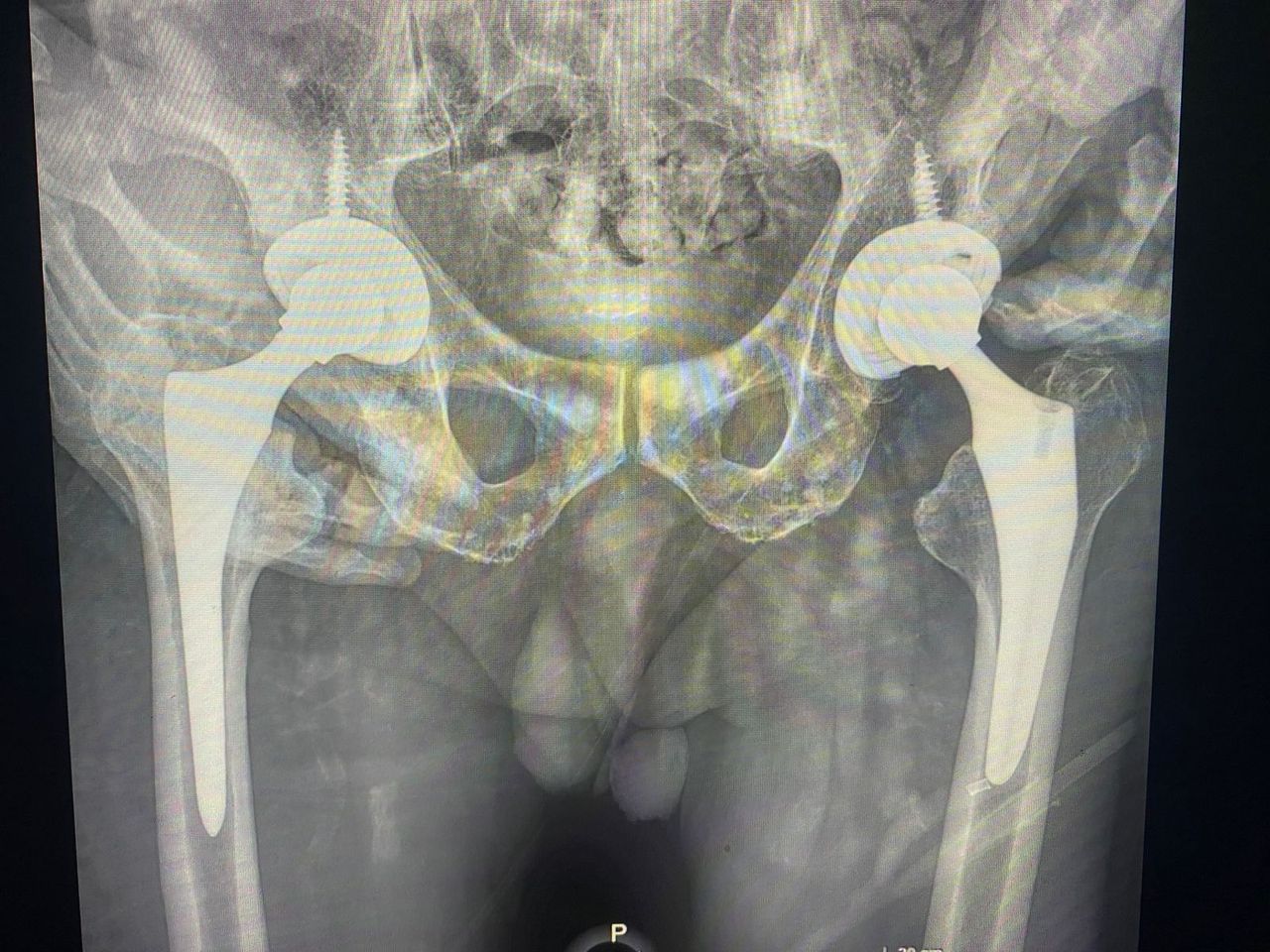 Andres Mercado Arce-3