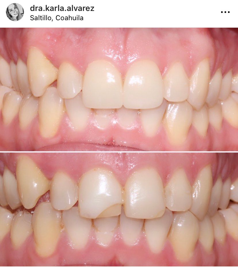 Karla Alvarez Treviño-17