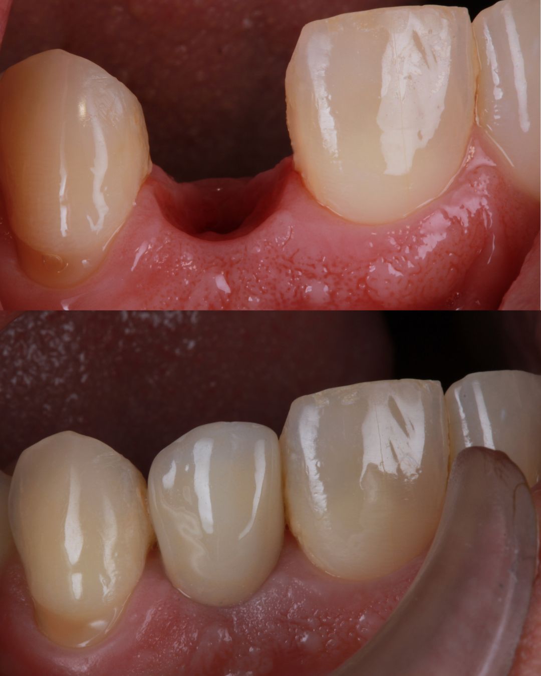 Diana Chacon Cervera-12