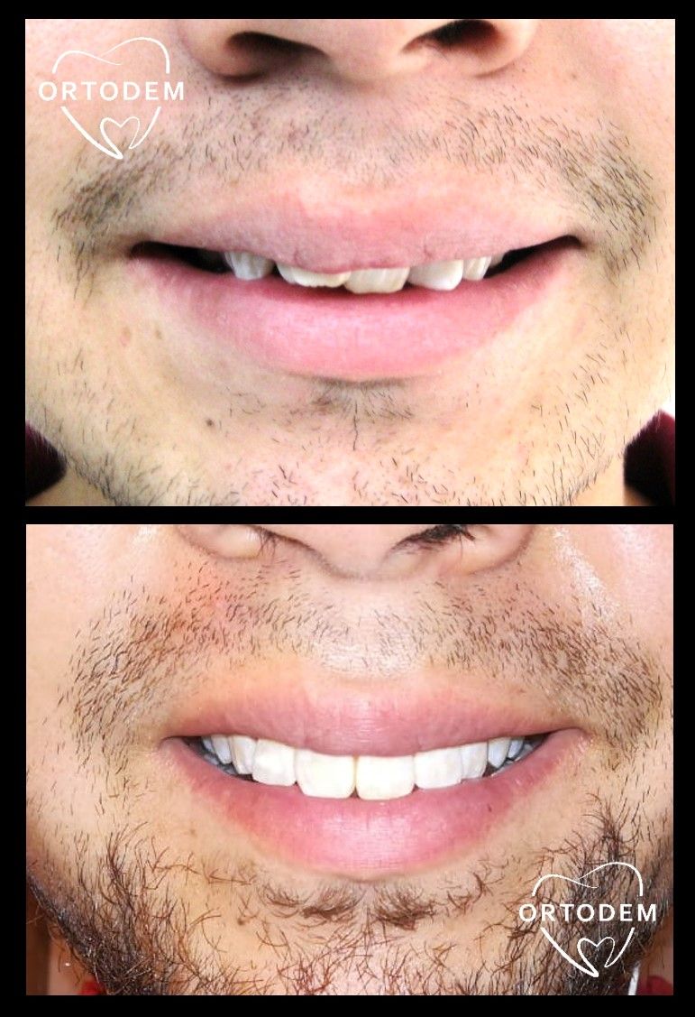 Elizabeth Morelos Morales-16