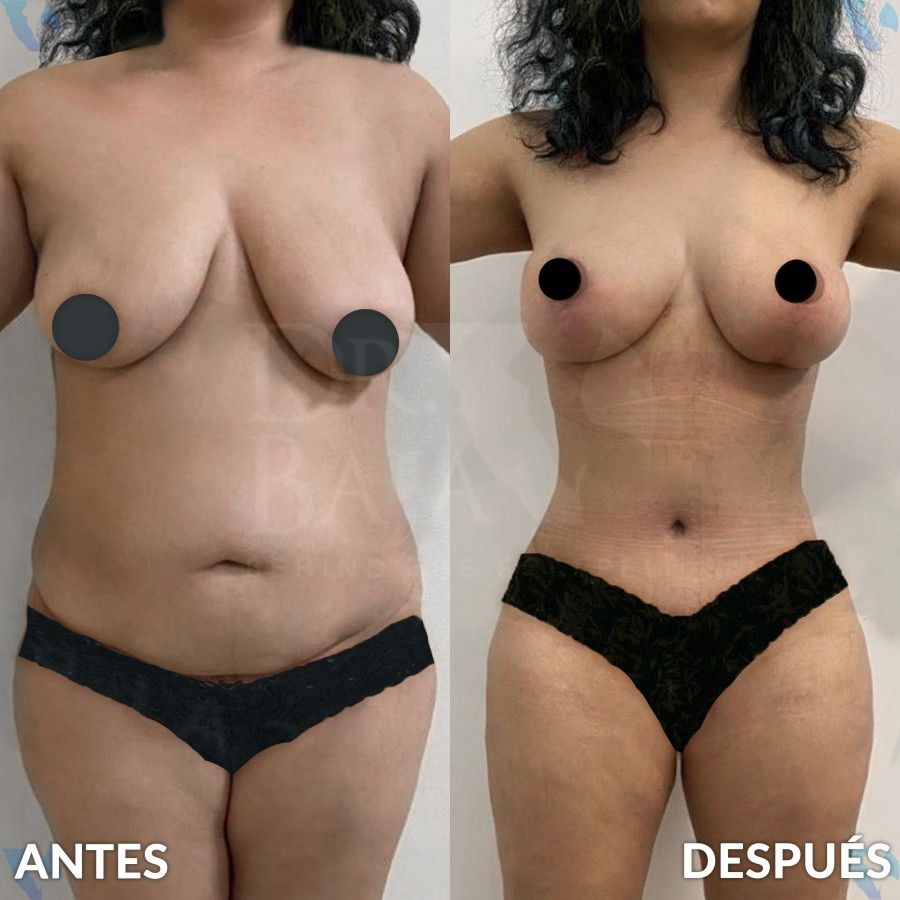 Renato Rodríguez Hirales-19