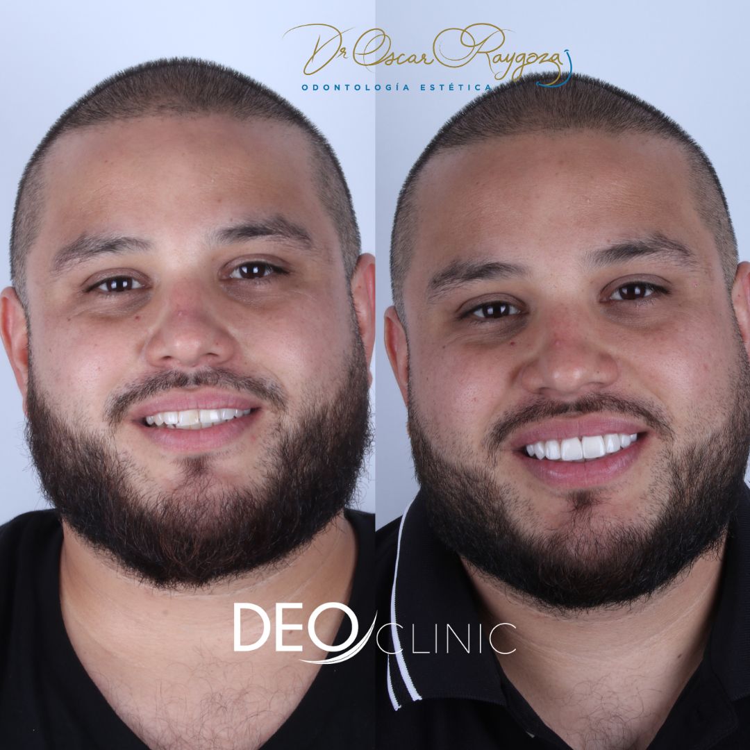 Oscar Raygoza Carrillo-27