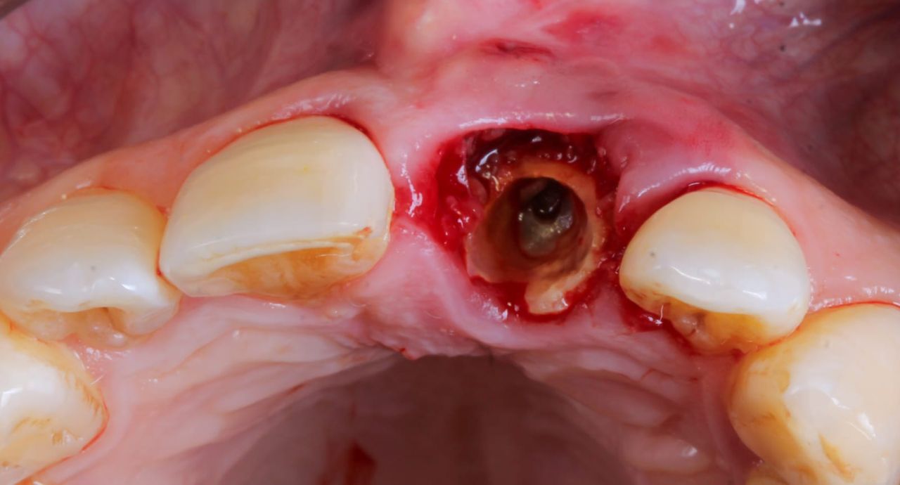 Hugo Enrique Aguilar Lamas-16