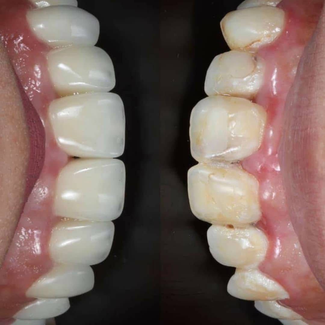 Maxwell Alejandro Moran Gonzalez-3