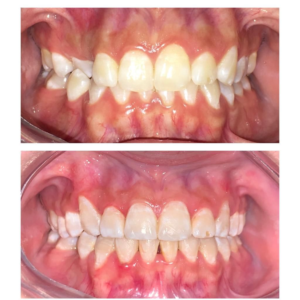 Blanca Elvia Soto Canales-10