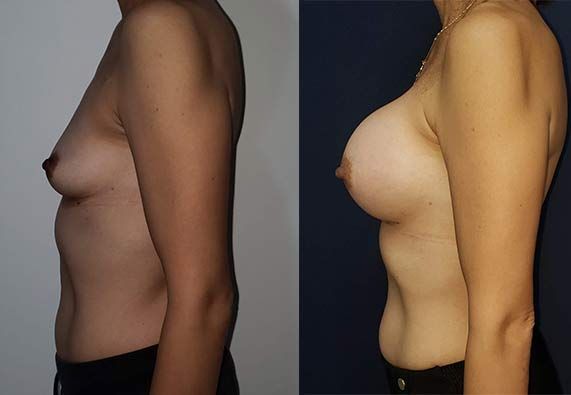 Edgar Ernesto Torres Mejía-19