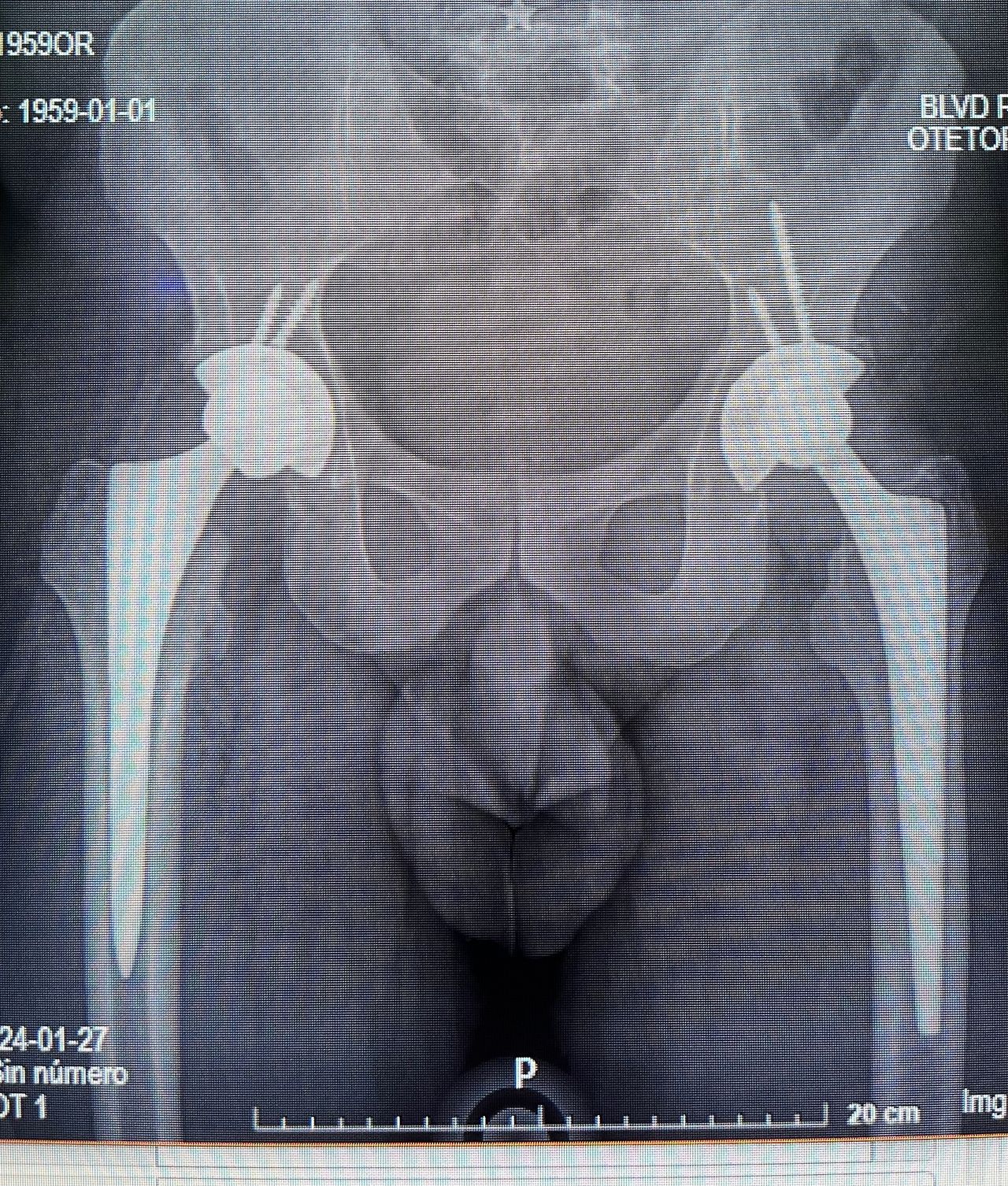 David Bernadac Giacomán-2