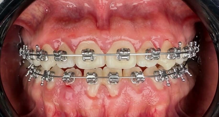 Martha Alicia Ceniceros Betancourt-14