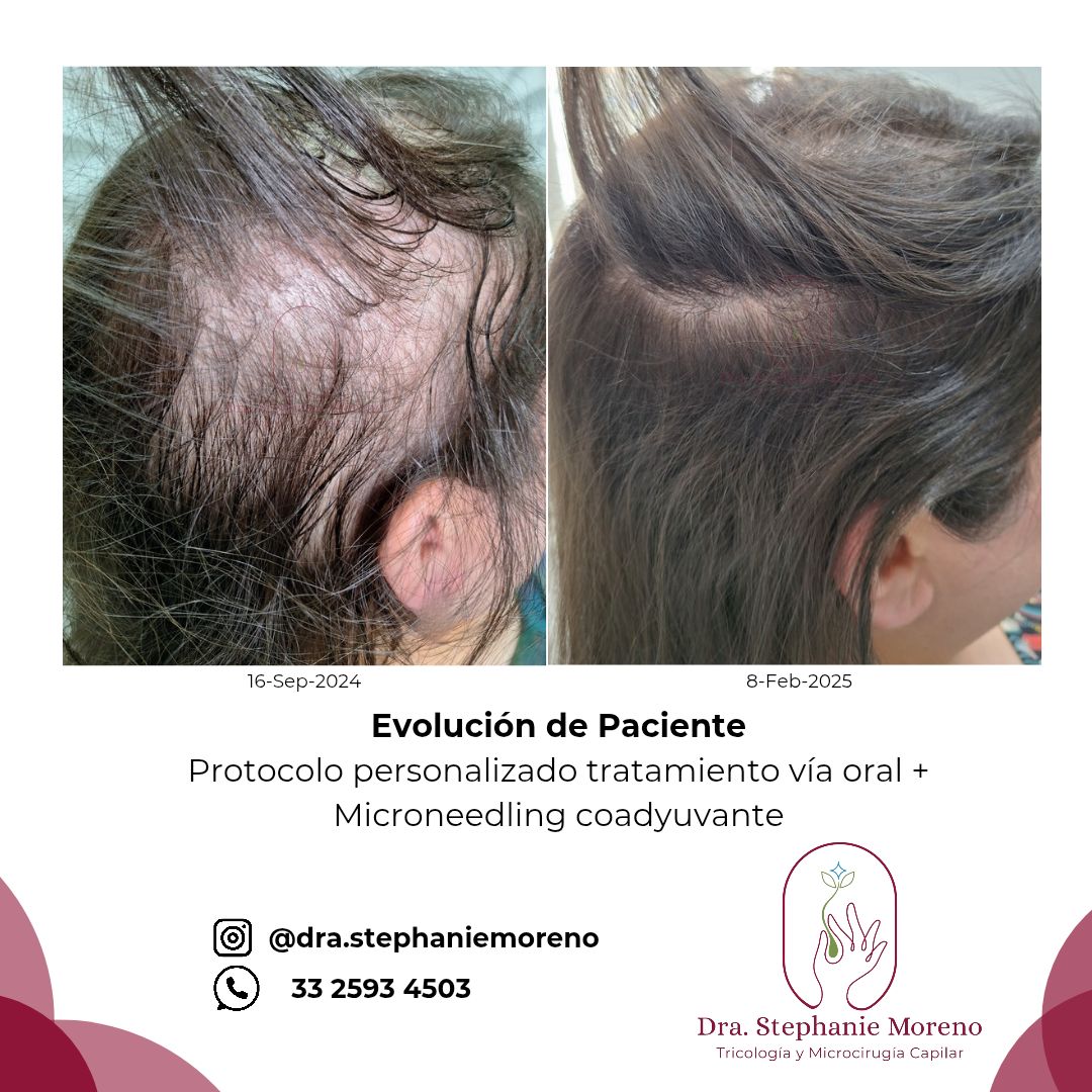 Stephanie Sarahí Moreno Elizalde-0