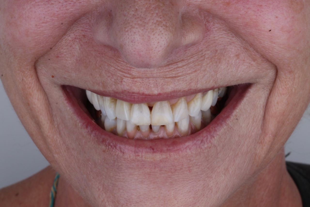 Iliana Astorga Avilez-15