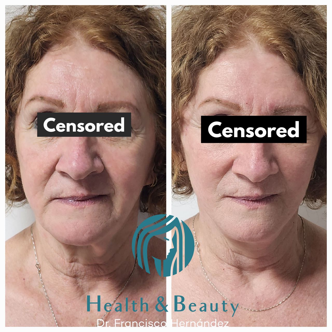 Francisco Hernández Gómez Crespo-59