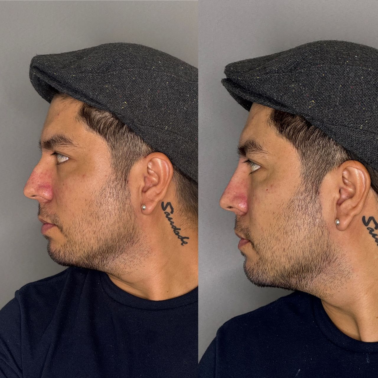 Juan Antonio Munguia Baltodano-3