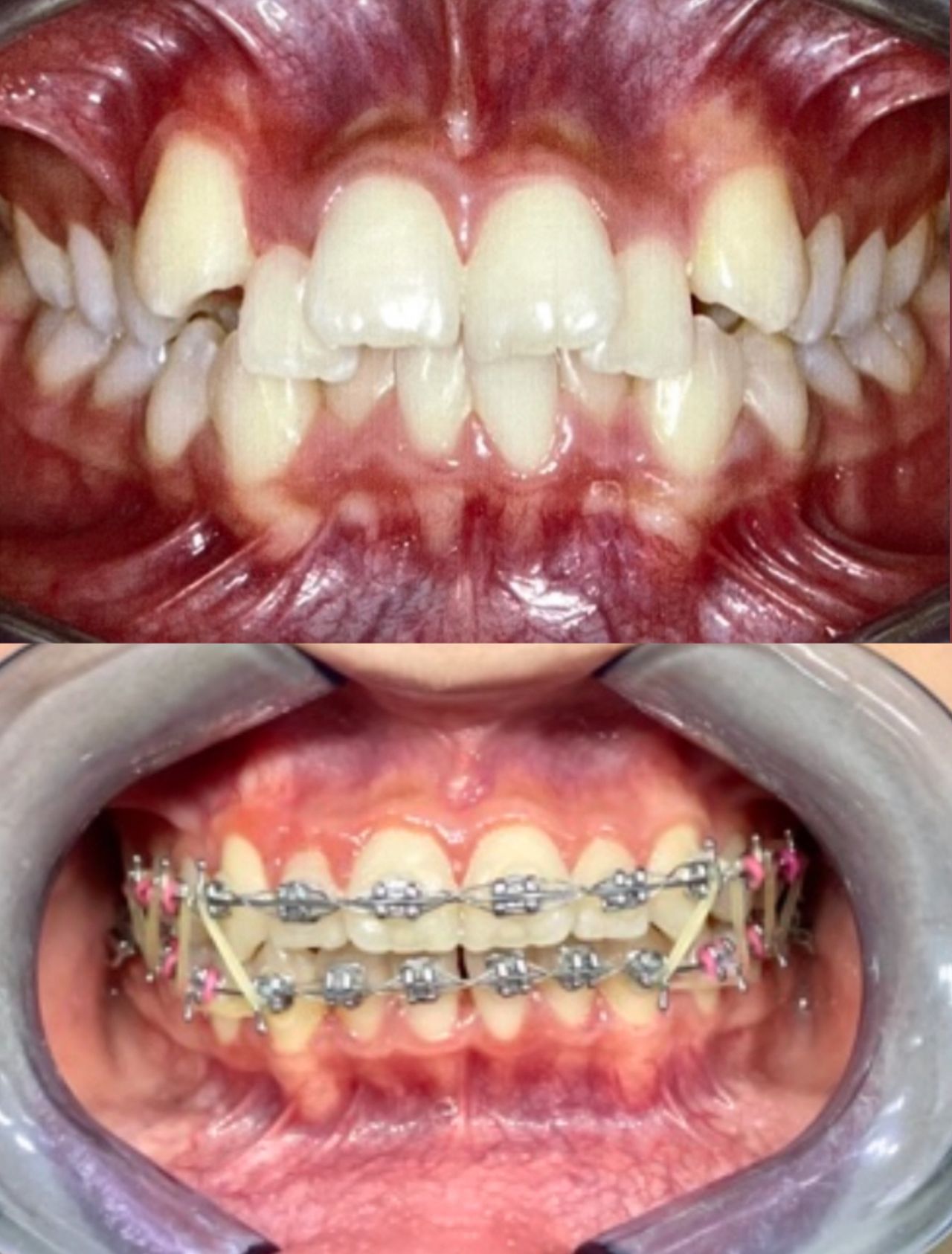 Ulises Alvarado Rodríguez-7