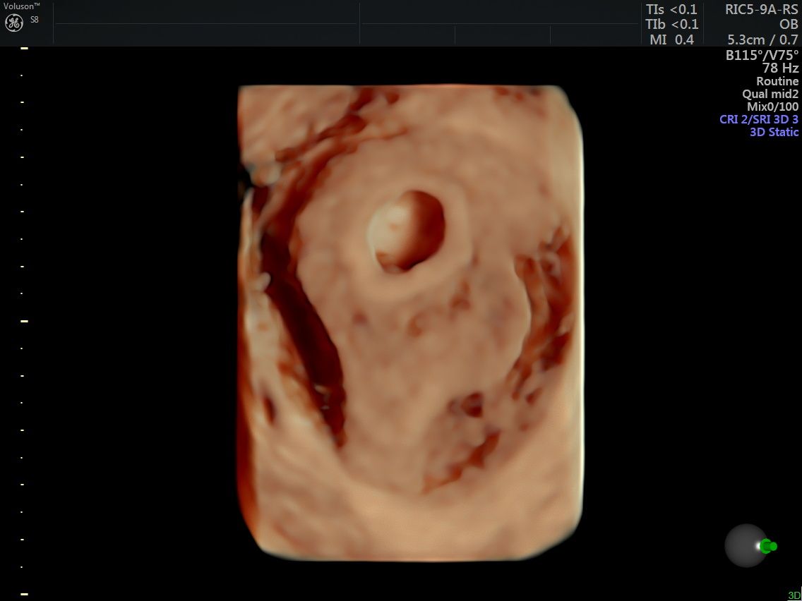 Griselda Reyes Torres-71