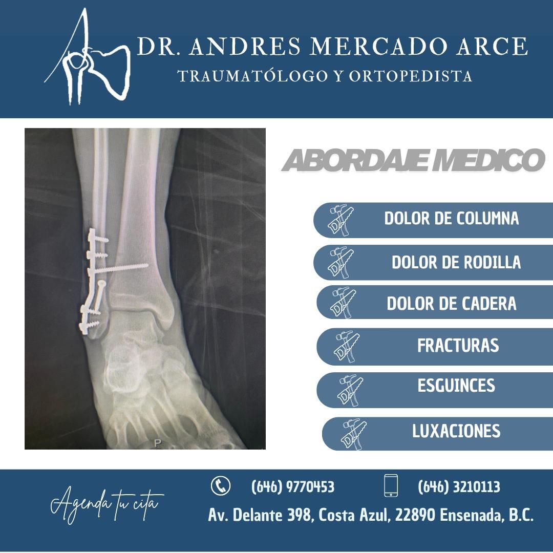 Andres Mercado Arce-6