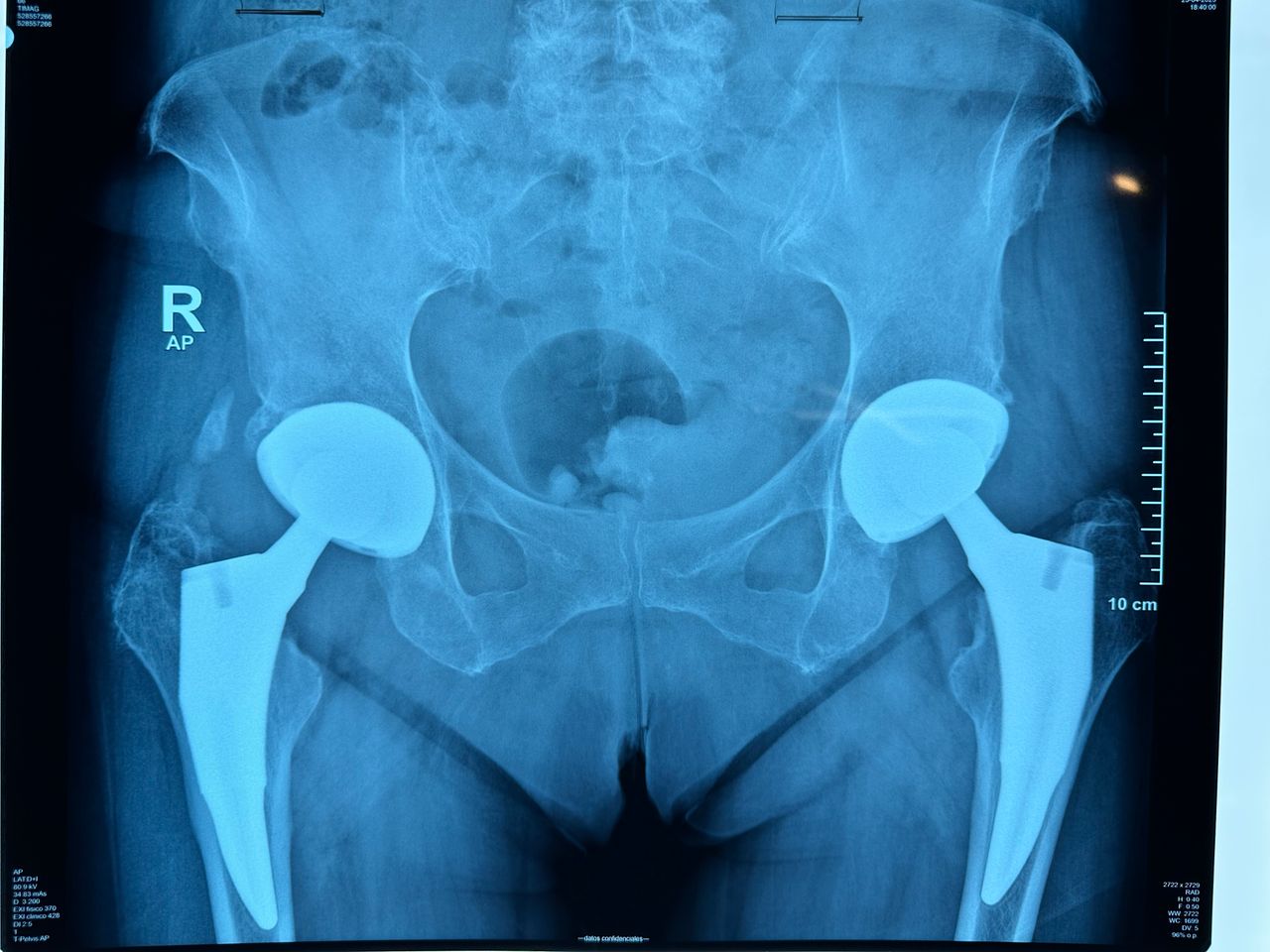 Alejandro Martínez Ramírez-53