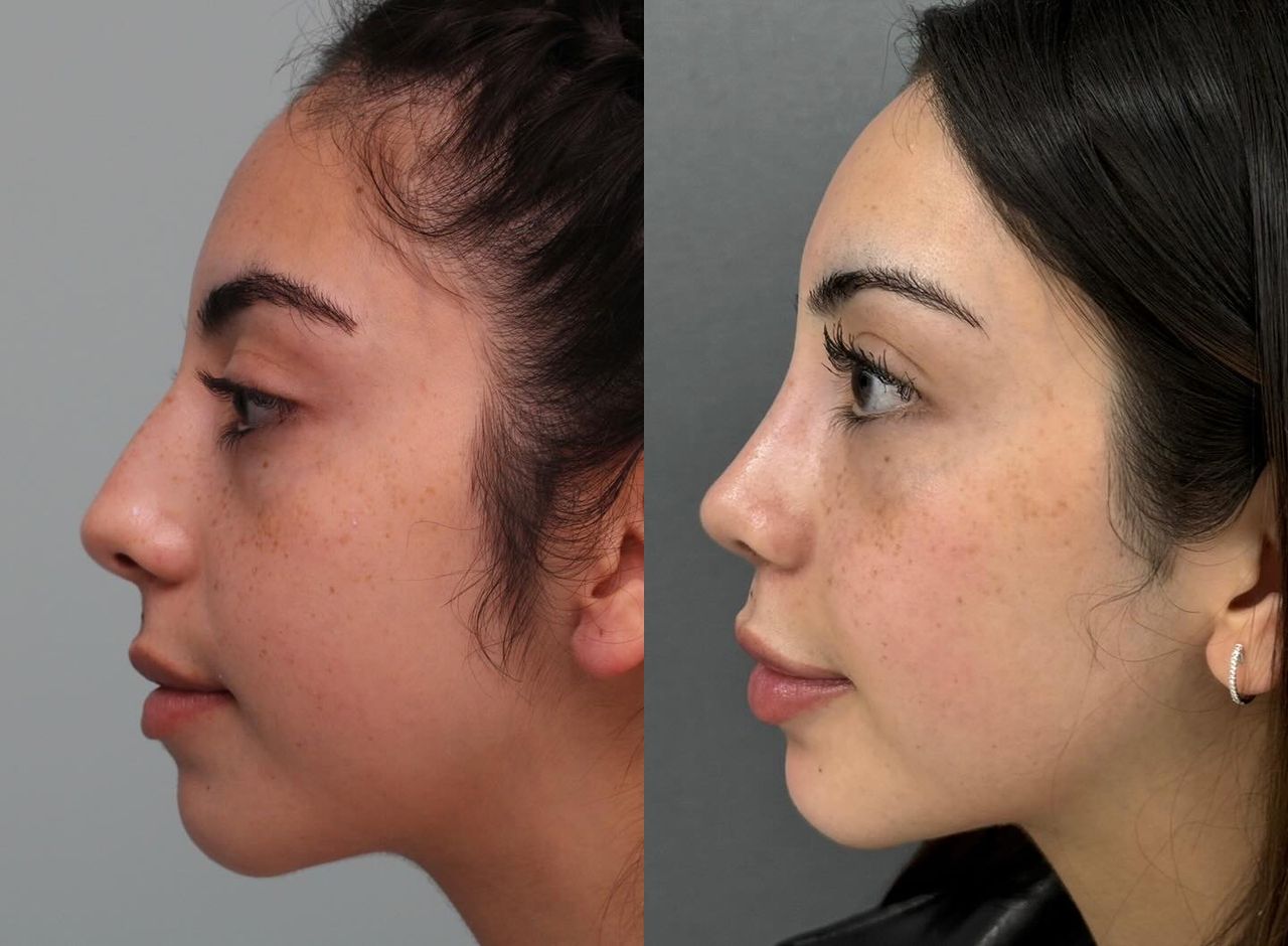 Angel Castro Urquizo-134