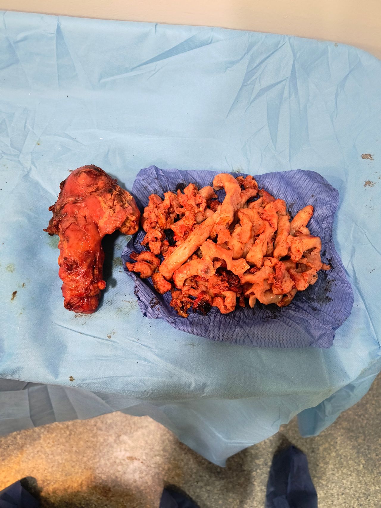 Benjamín Ayax Abraham Mejía Mendoza-8