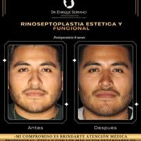 Enrique Serrano Cruz-22