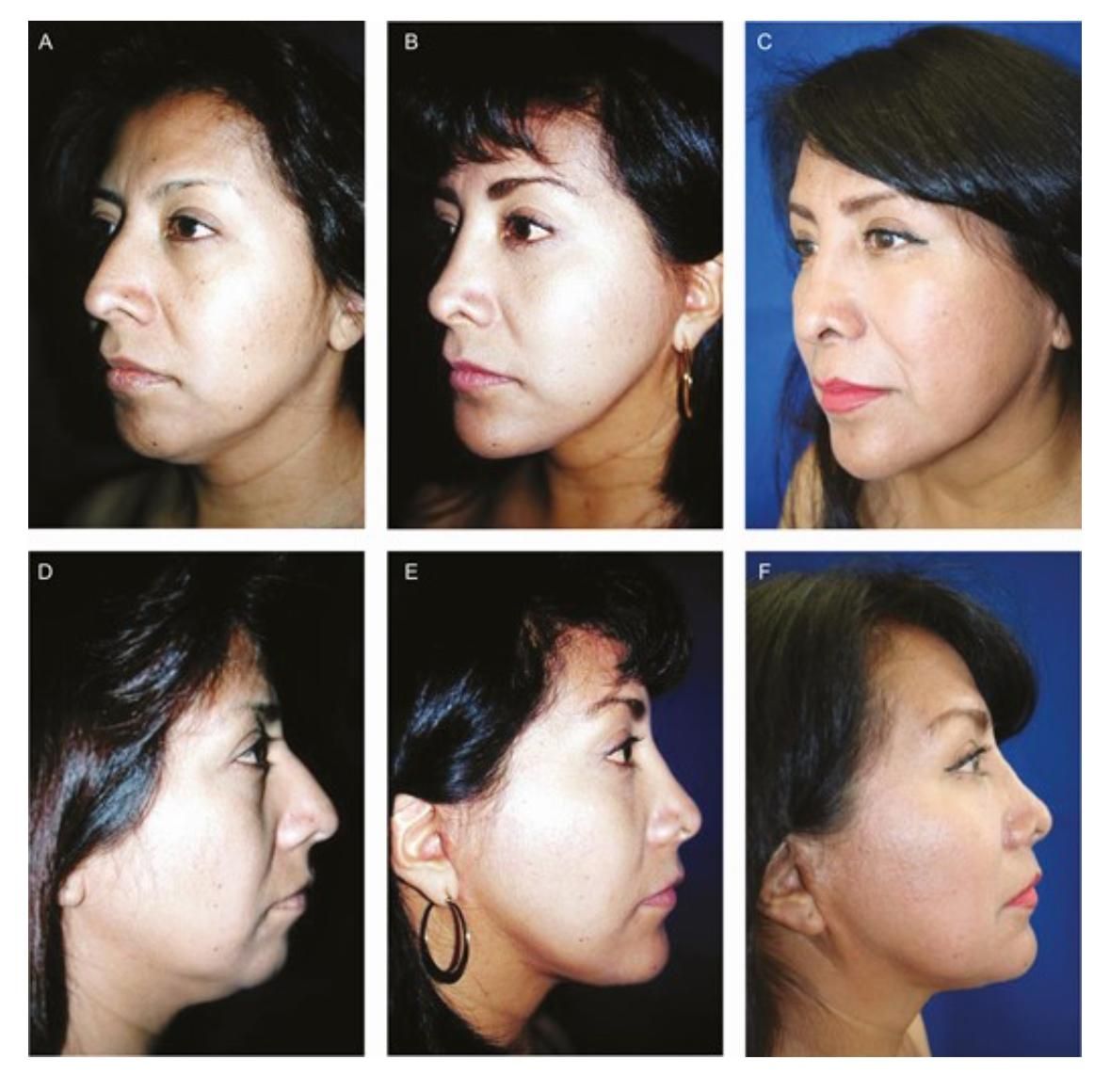 Porfirio Castillo Campos-0