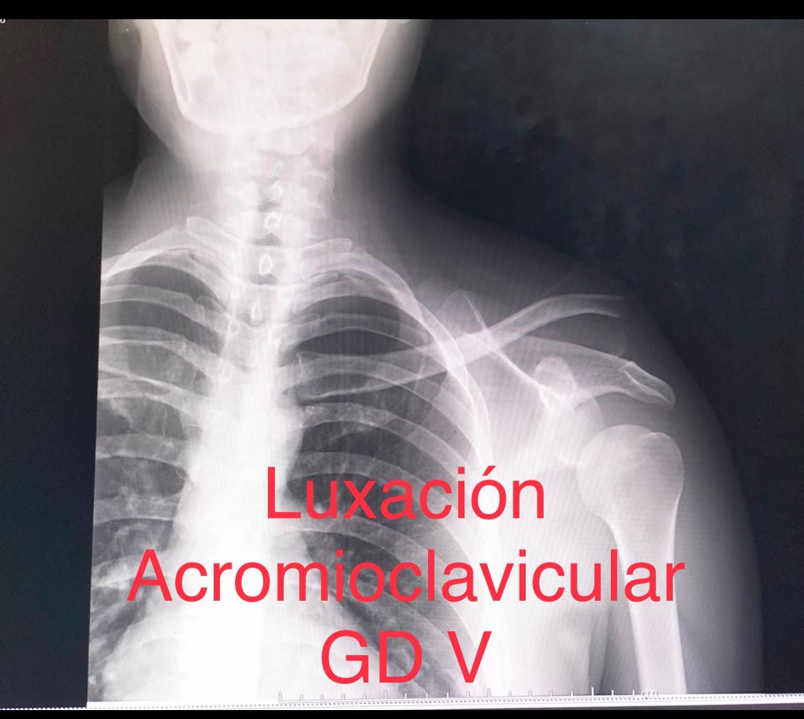 Emmanuel Bolaños Cortes-13