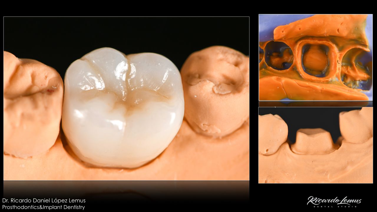 Ricardo López Lemus-61