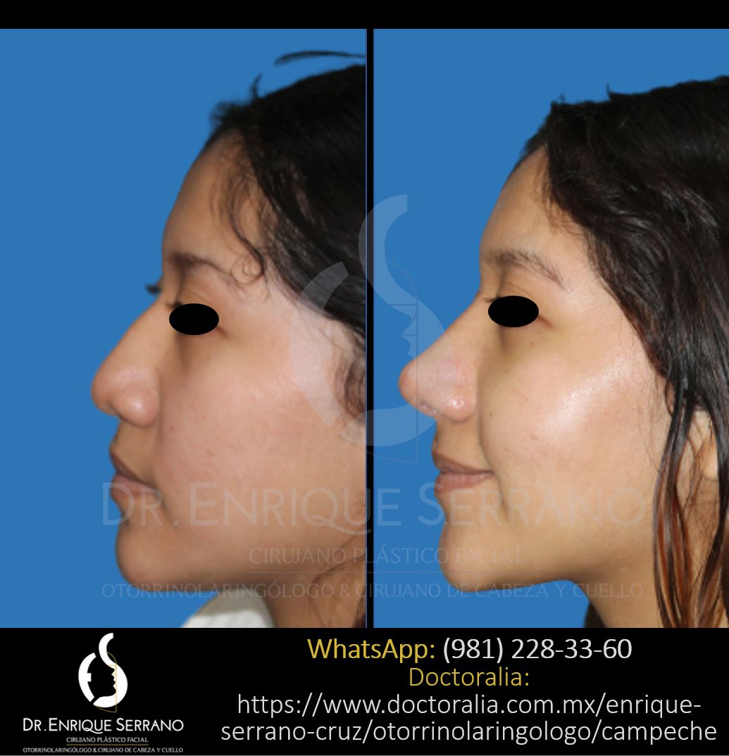 Enrique Serrano Cruz-44