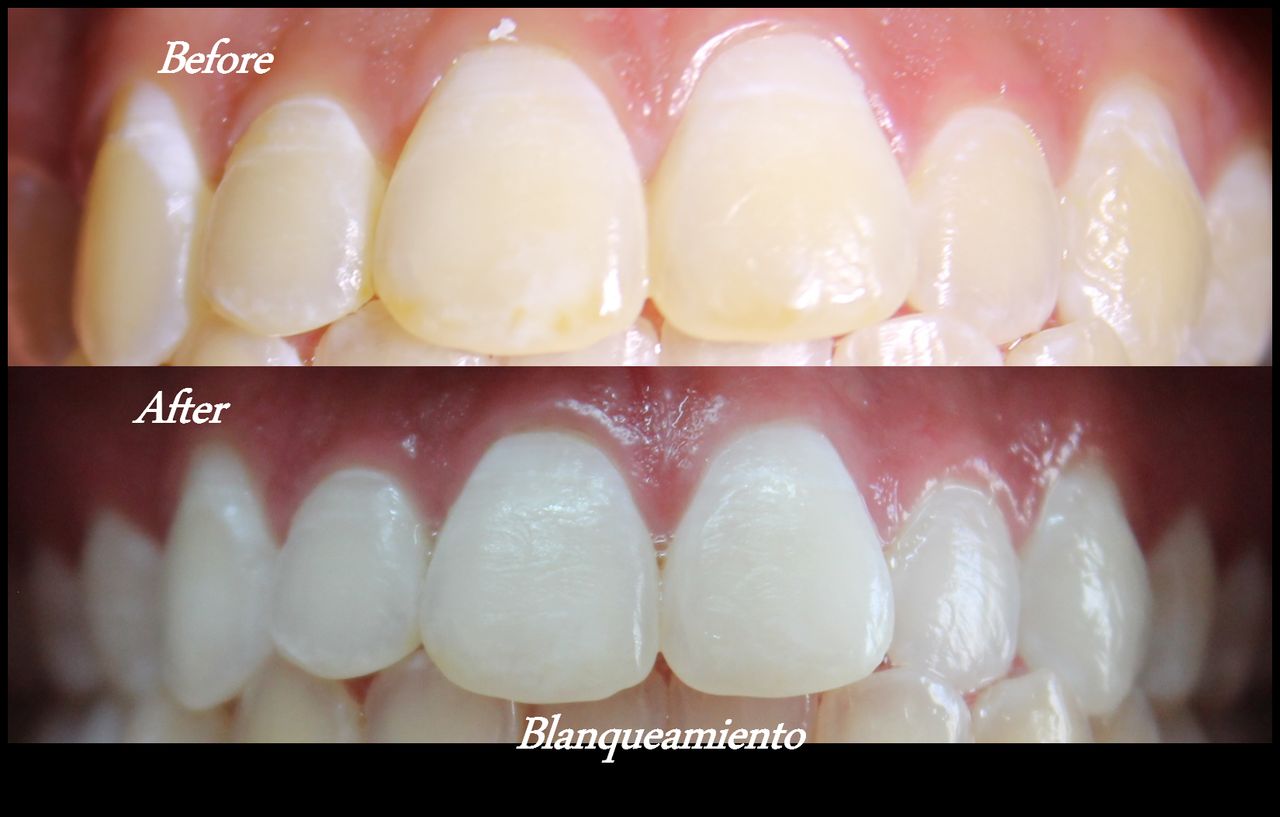 Aimee Valles Monárrez-37