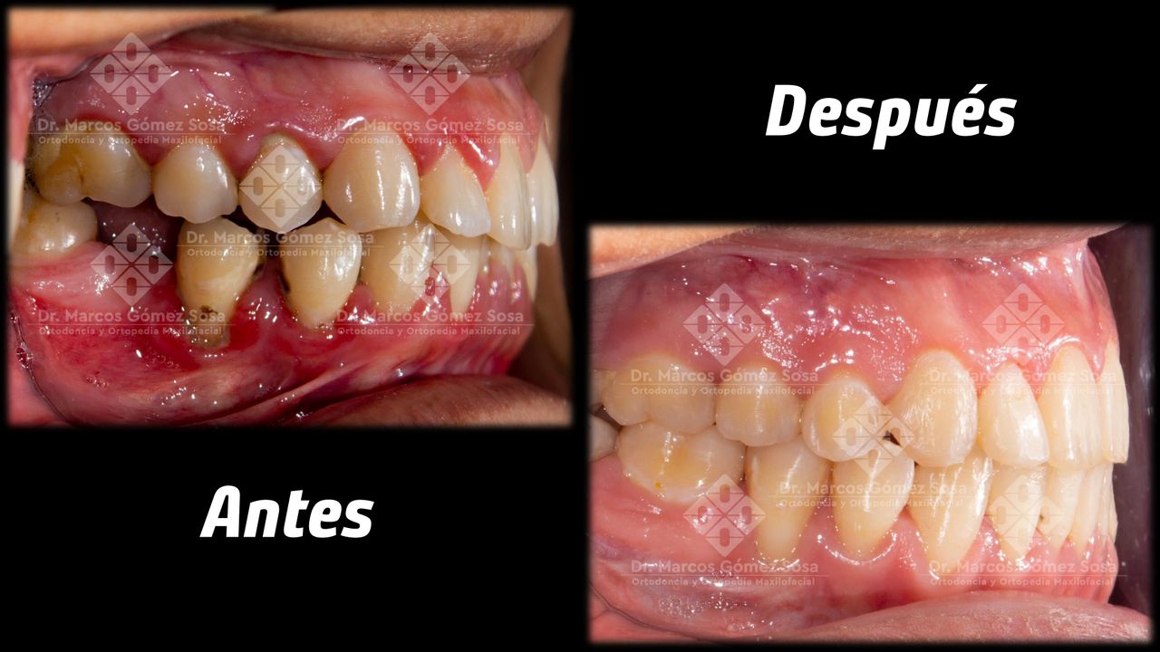 Marcos Gómez Sosa-14