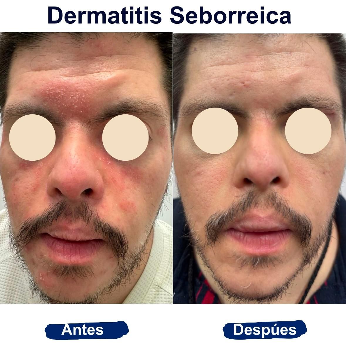 Itzel Anayn Flores Reyes-29