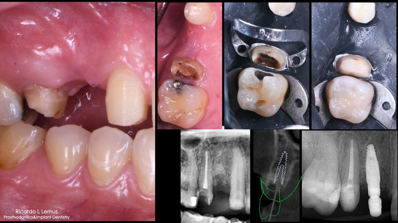 Ricardo López Lemus-129