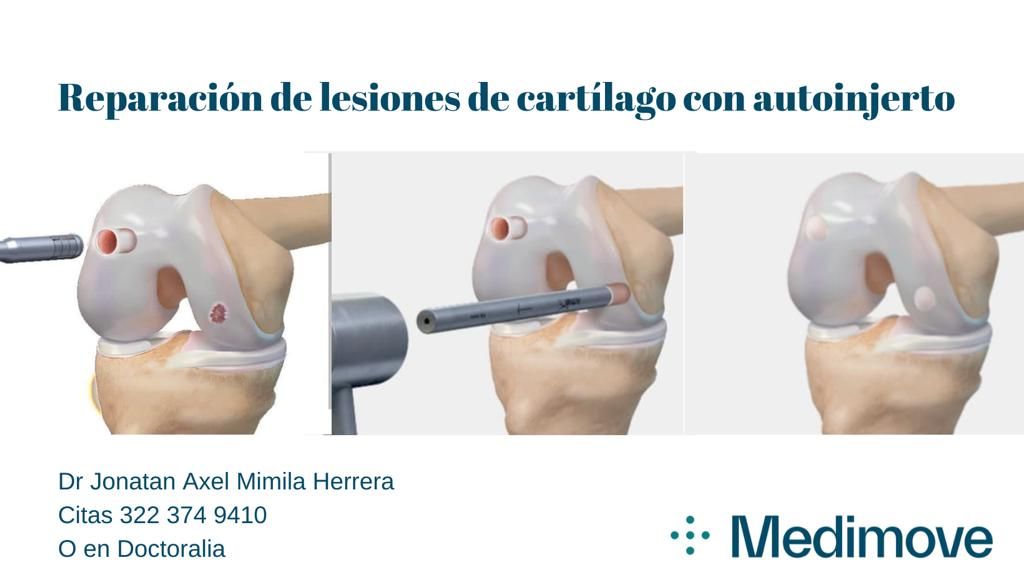 Jonatan Axel Mimila Herrera-14