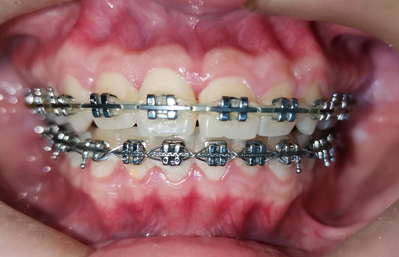 Emma Selenia Hernández Castillo-25