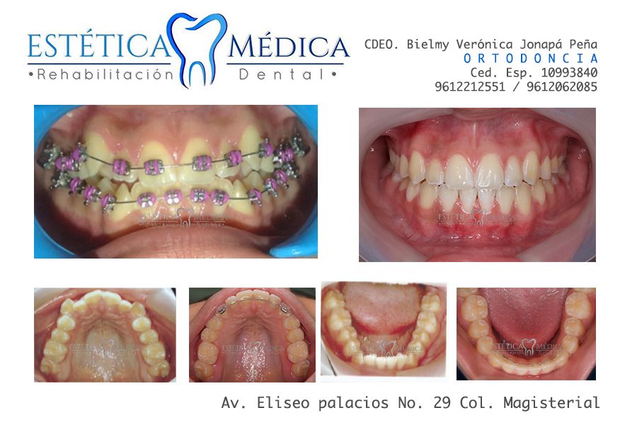 Bielmy Veronica Jonapa Peña-40