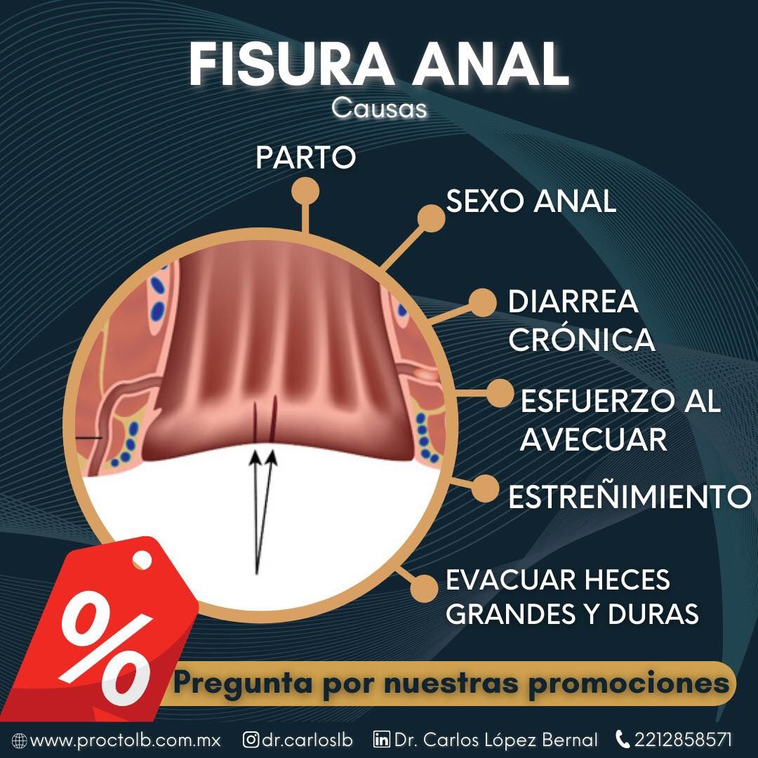 Carlos Alberto López Bernal-8