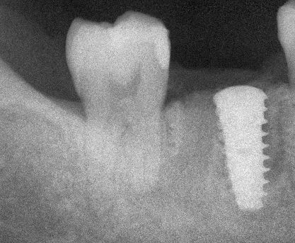 Ivan Torres Rascon-12