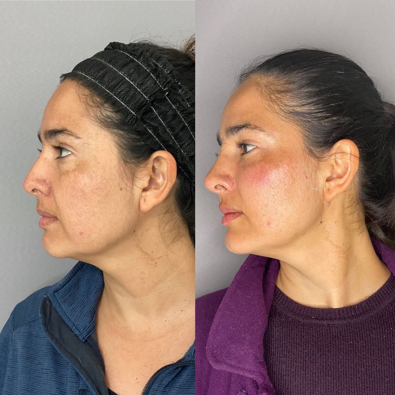 Juan Antonio Munguia Baltodano-2