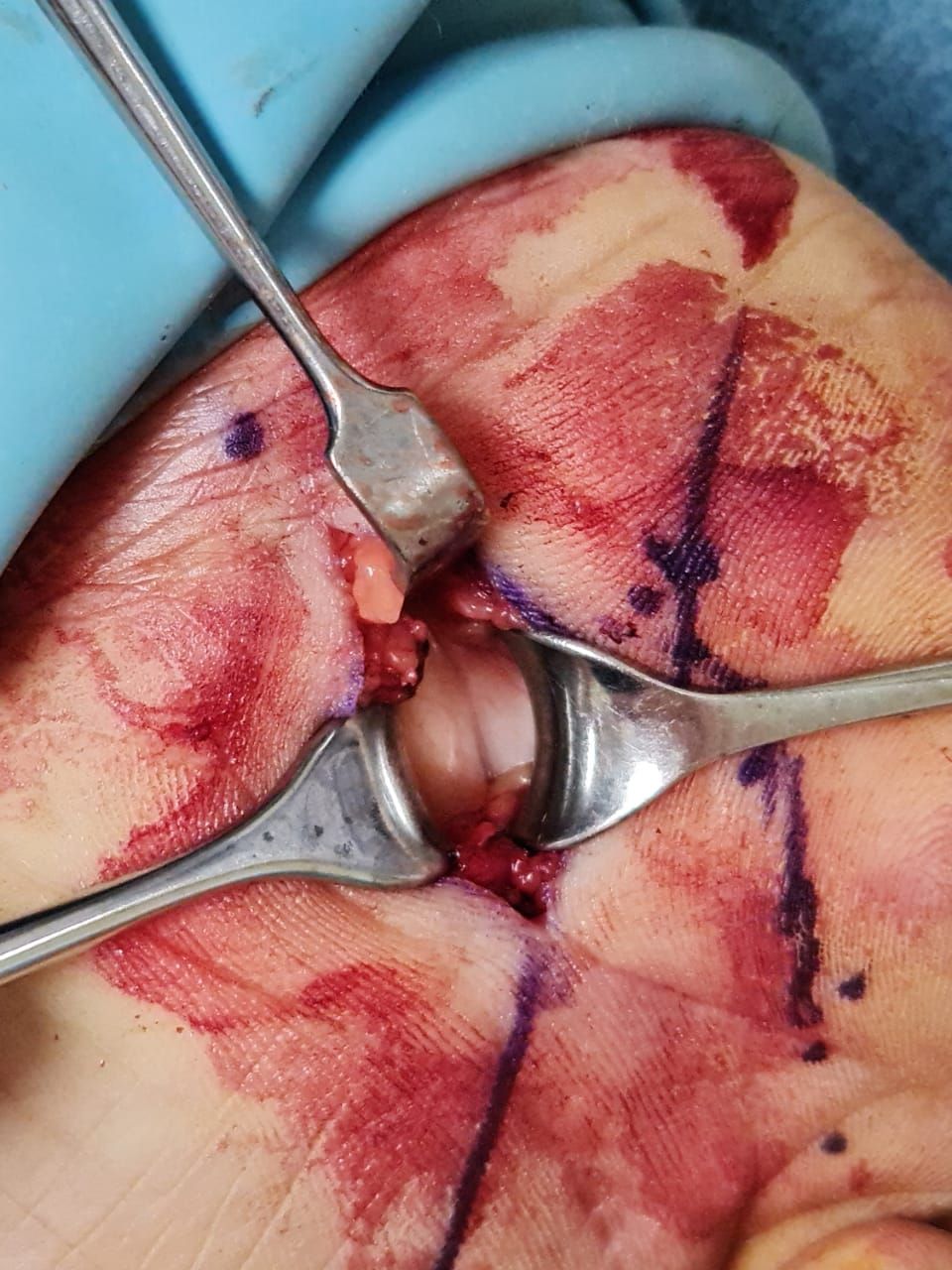 Victor Manuel Valdez Tapia-3