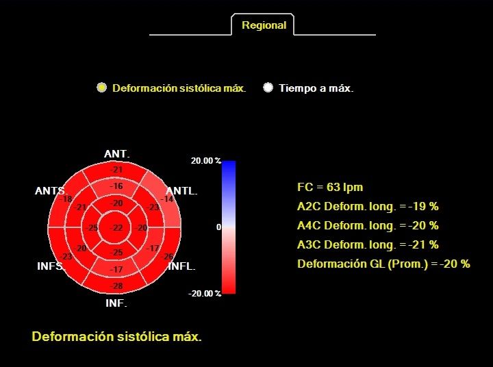 Heriberto Pruneda Ayala-19