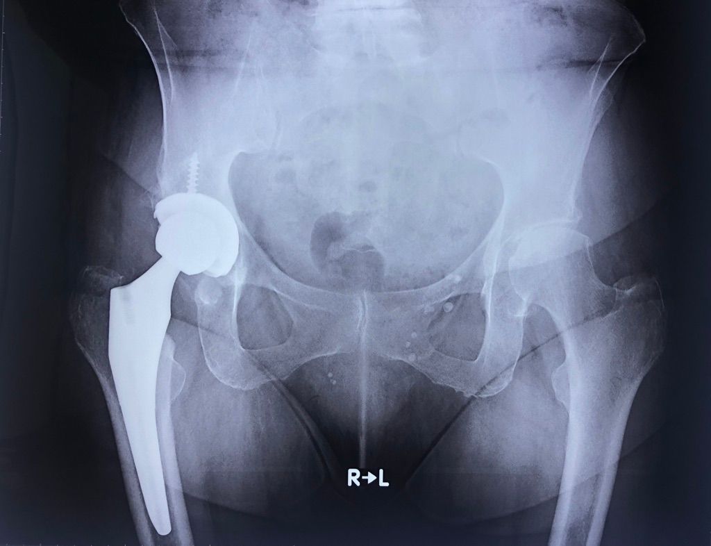 Gisela Cleto Zepeda-91