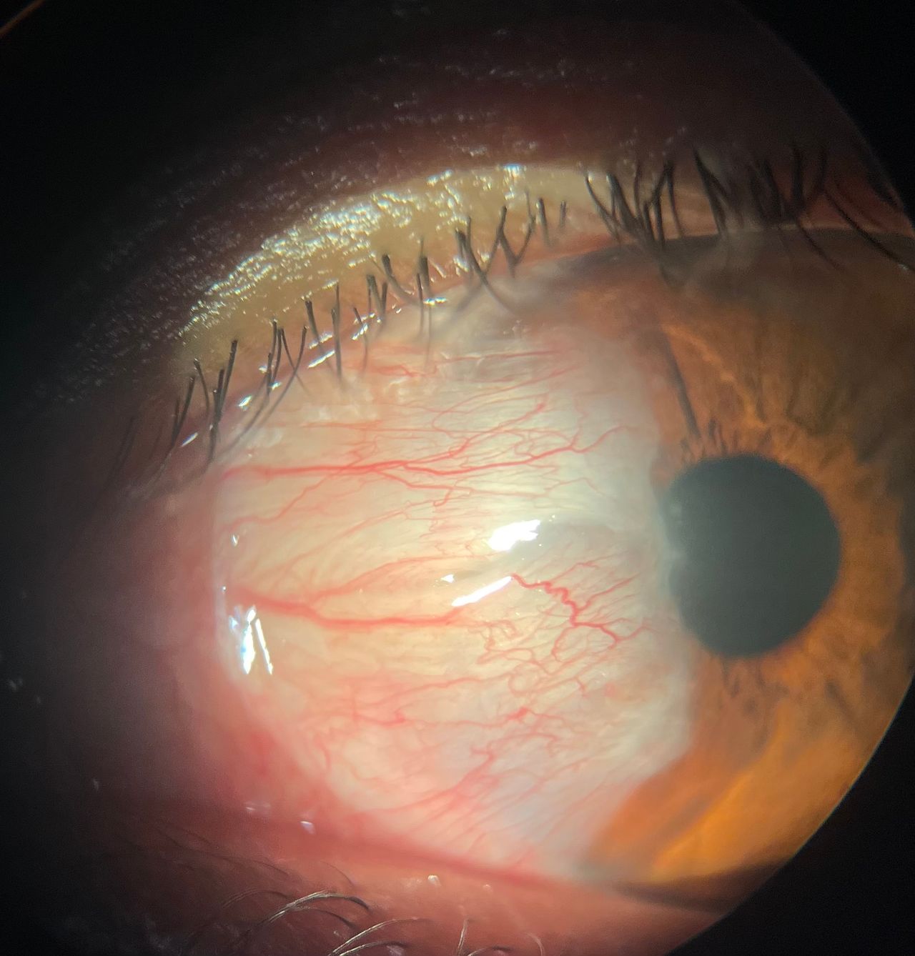 Blanca Esmeralda Hurtado Noriega-2