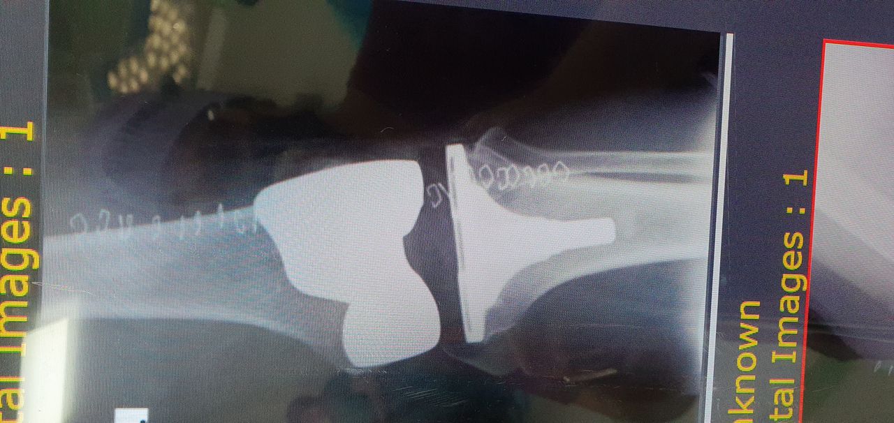 Carmen Yossaleth Briceño González-0