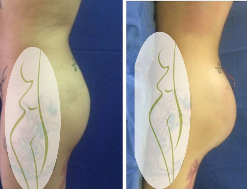 Rubén Nieto Balcázar-6