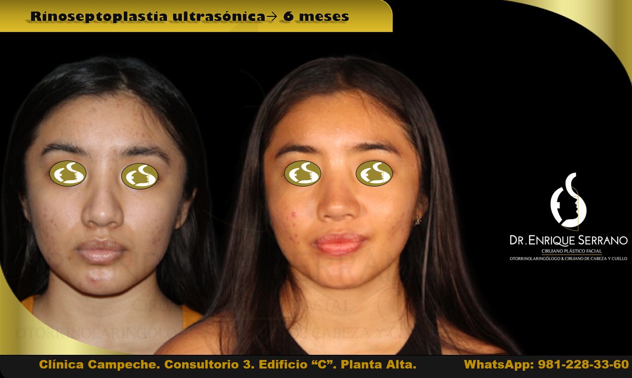 Enrique Serrano Cruz-33