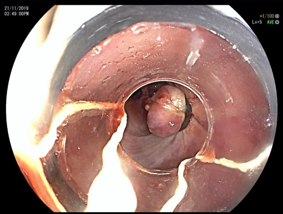 Alejandro Arreola Cruz-8