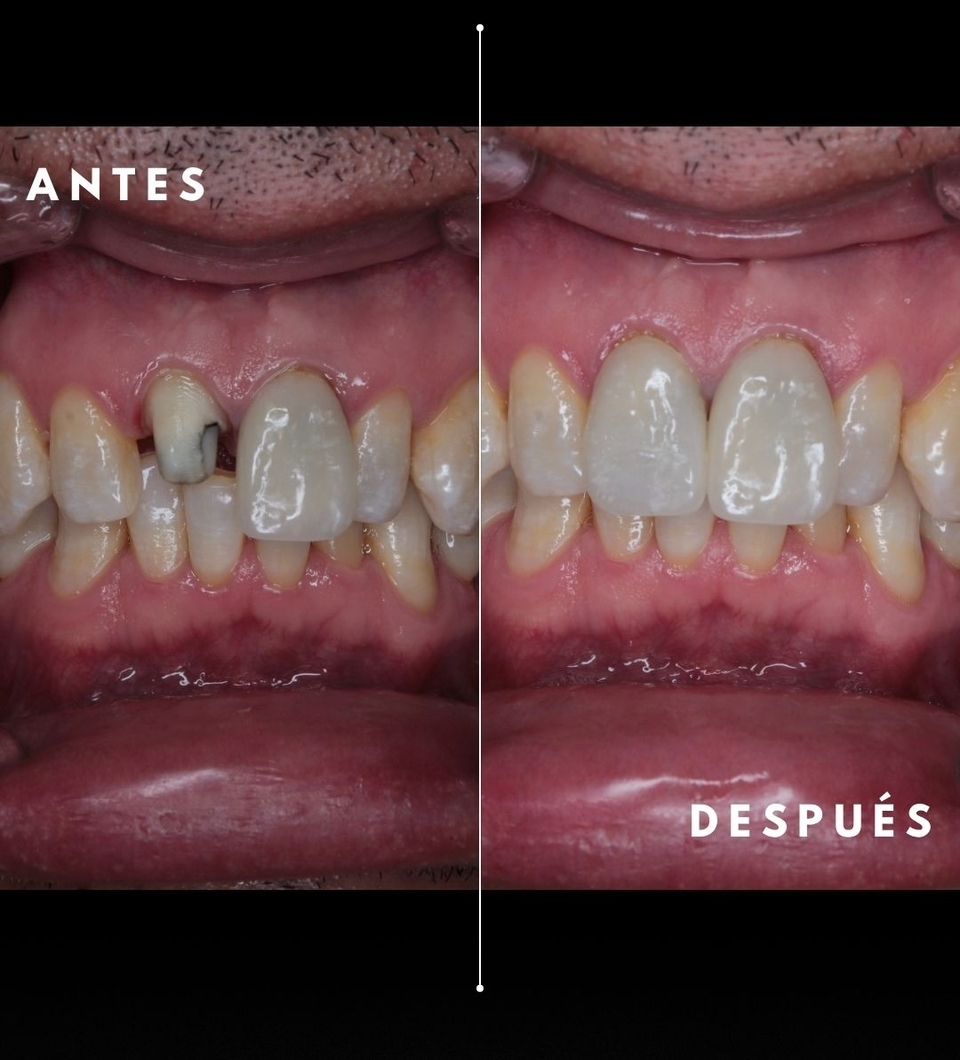 Carlos Enrique Hernández Rodríguez-29