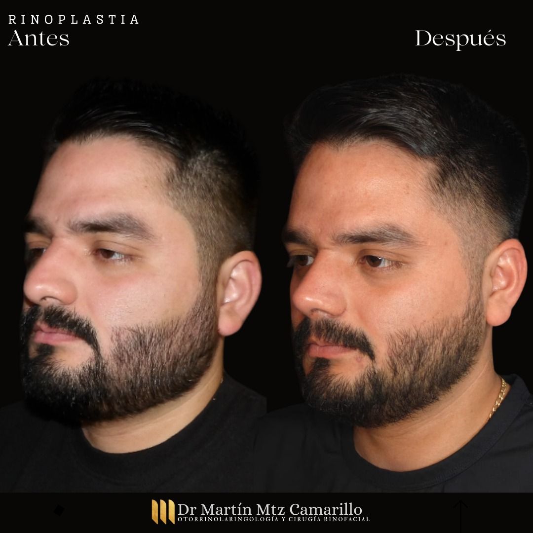 Martín Martínez Camarillo-23